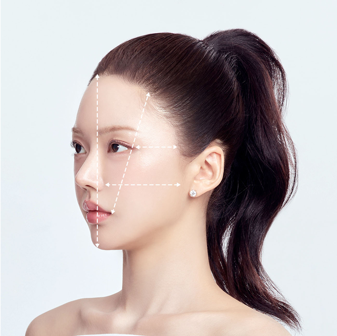 Side ratio measurement