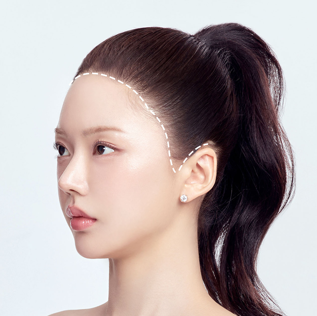 Side line design