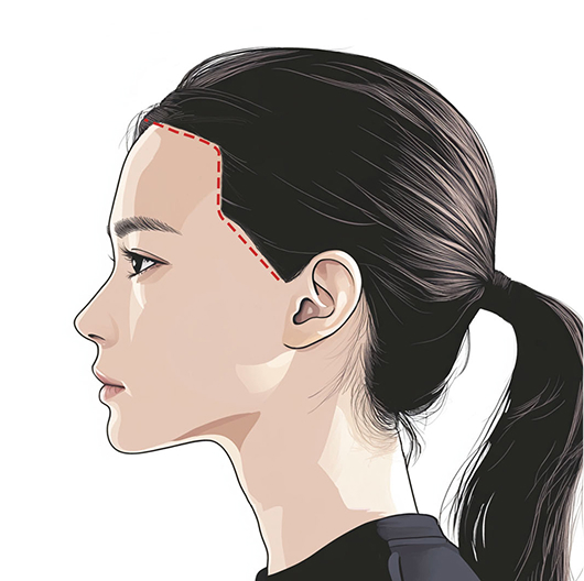Side line design