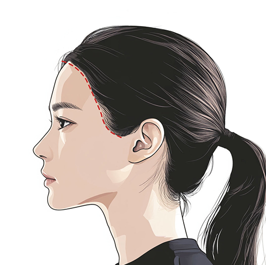 Side line design