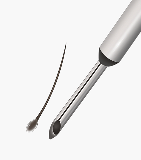 Incision hair transplant surgical method