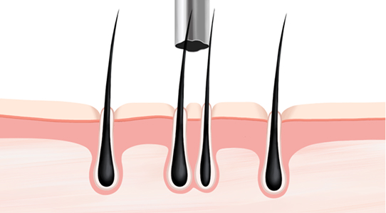 Indiscriminate harvesting