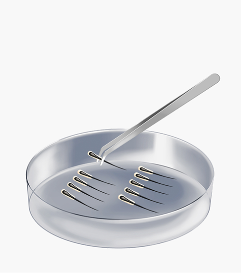 Incisional hair transplant surgery method