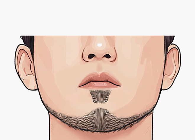 박스형 구레나룻