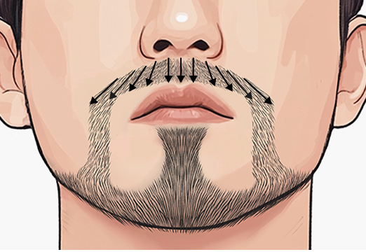 수염의 방향, 각도를 살린 이식 스킬