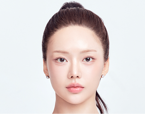 절개 모발이식 after