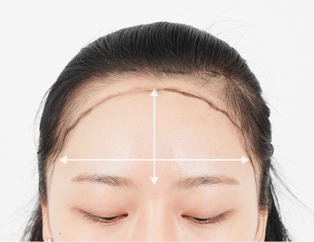 넓은 이마 이마 축소 효과